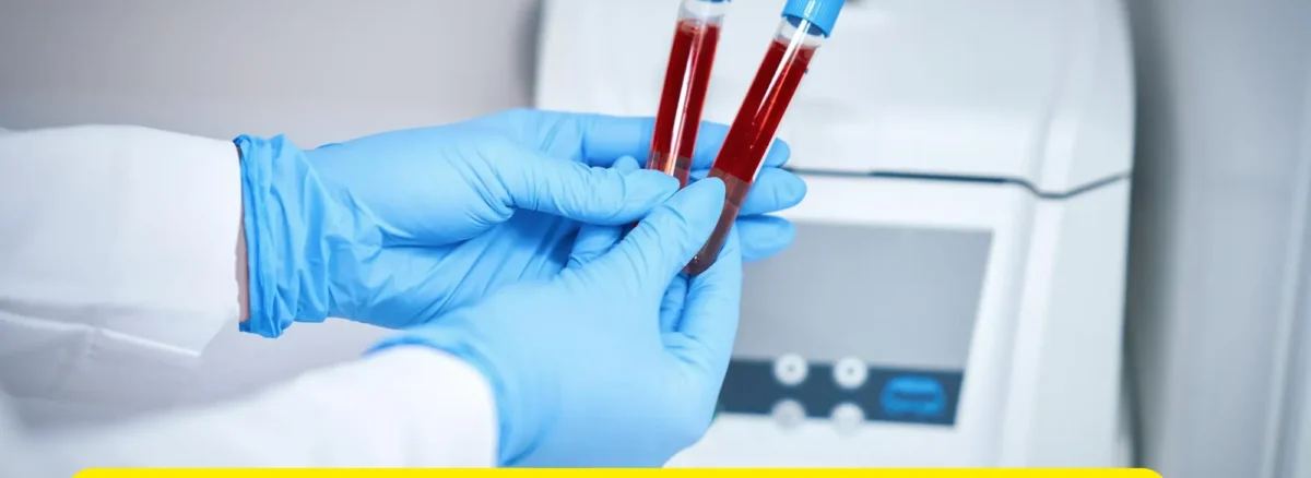 Are Timely & Accurate Blood Test Results Vital?